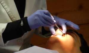 orthodontist 287285 640