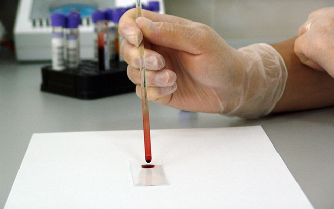 test sangue provetta
