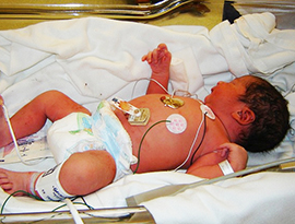 corta punto nascite bebe culla