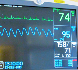 corta monitor cardiologia